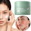 Improve Redness Moisturizing Cream Fade Acne Spots Skin Cream Post Whitening Care Skin Repair F F3B2