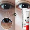 Fat Granules Remover Eye Cream Fade Fine Lines Reduce Dark Circles Repair Barrier Anti-Puffiness Anti Inflammatory Cream