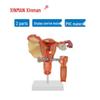Xinman Pathological Uterine Anatomical Model