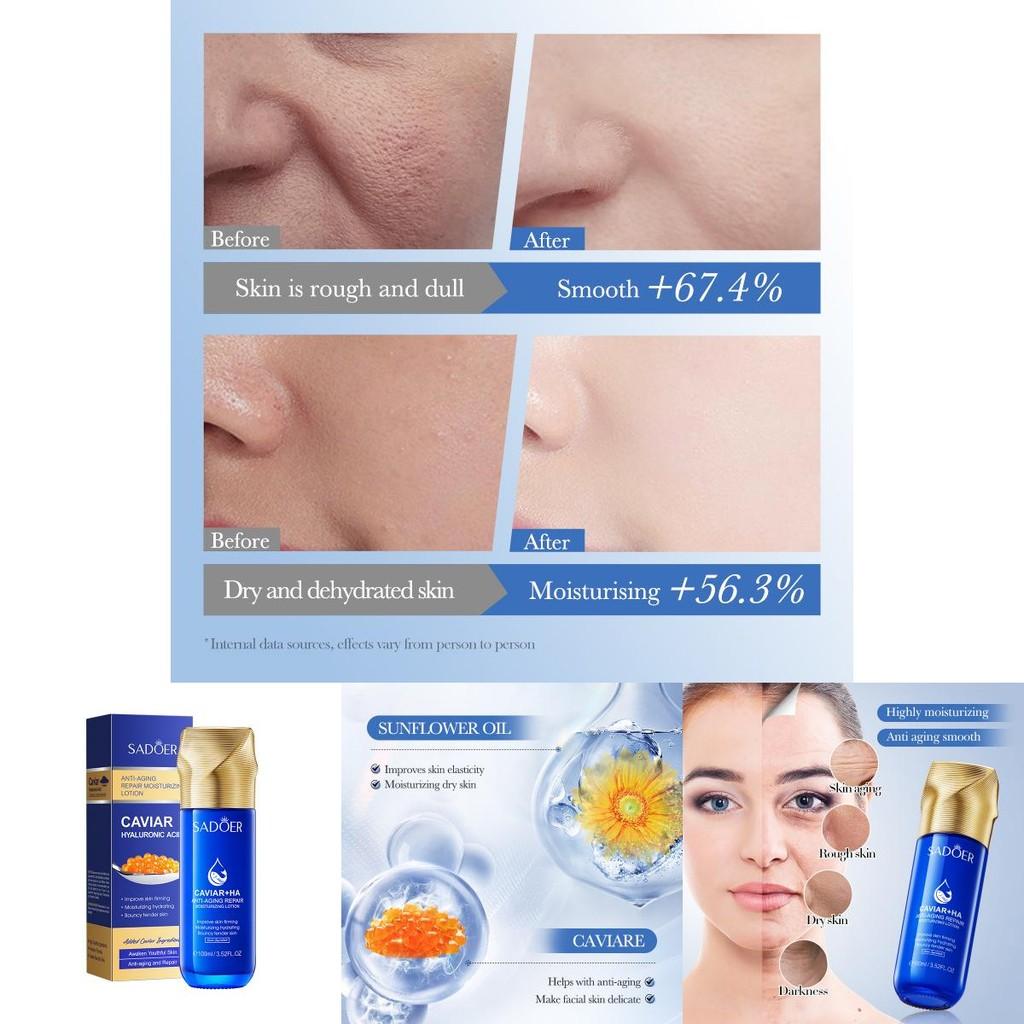 Sadoer Premium Hyaluronsäure Feuchtigkeitscreme Gegen Falten Und Für Feuchtigkeit 100ml