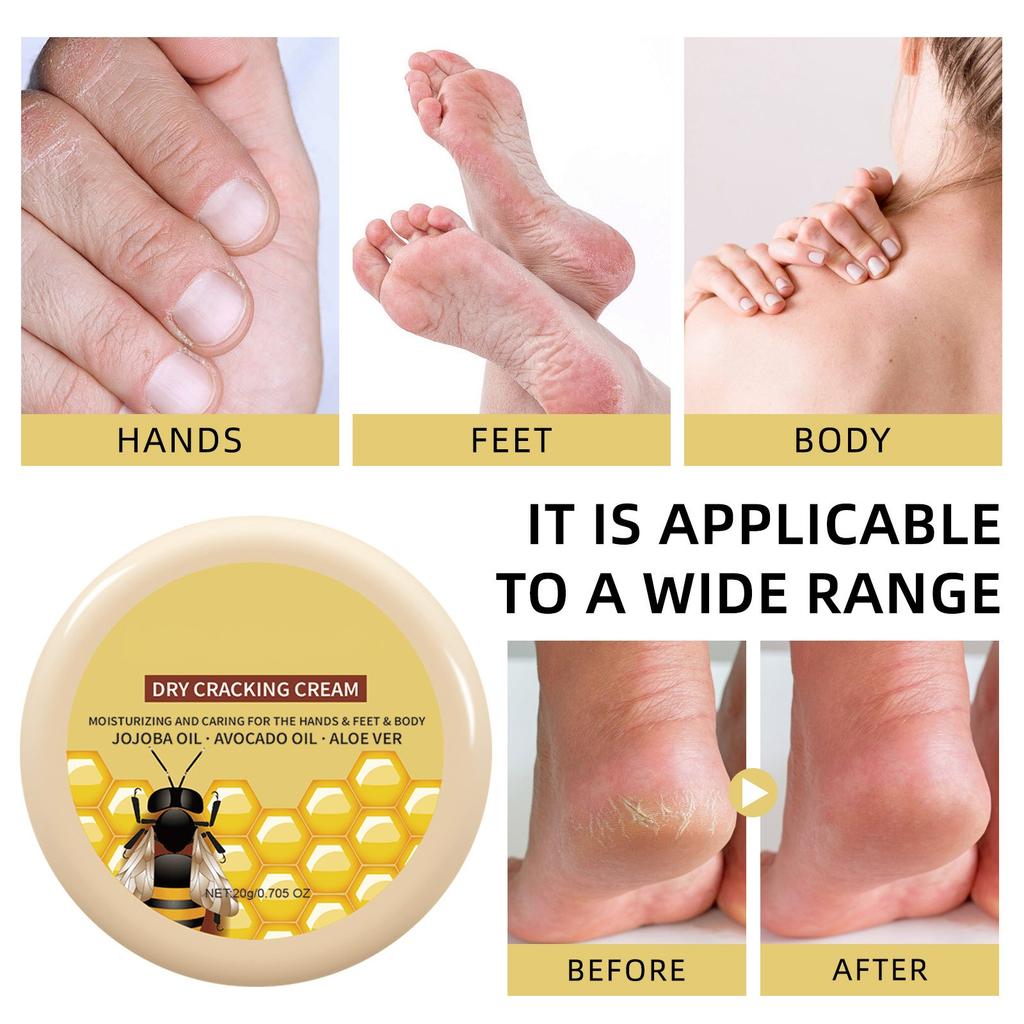 Bee Wrinkle Face Cream  For Extremely Dry Skin For Itchy Skin  And Puffiness 20G