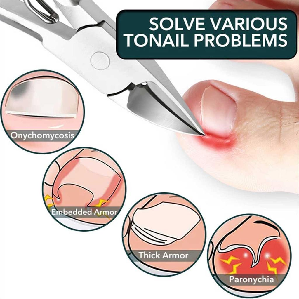 1PCS Toe Nail Clippers Cutter Ingrown Toenail Clipper Stainless Steel Professional Thick Nails Nail Cutter Cuticle Nippers