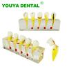 Dental Model Endodontic Pathological Teeth Pulp Cavity Model For Dentist Student Study Training Practice Demonstration Tools