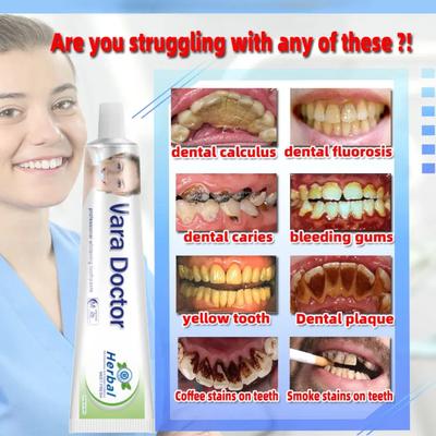 Dentifricio sbiancante da 100 g, rimozione del tartaro dentale, sbiancamento dei denti, rimozione dell'odore della bocca, alito cattivo, prevenzione della parodontite