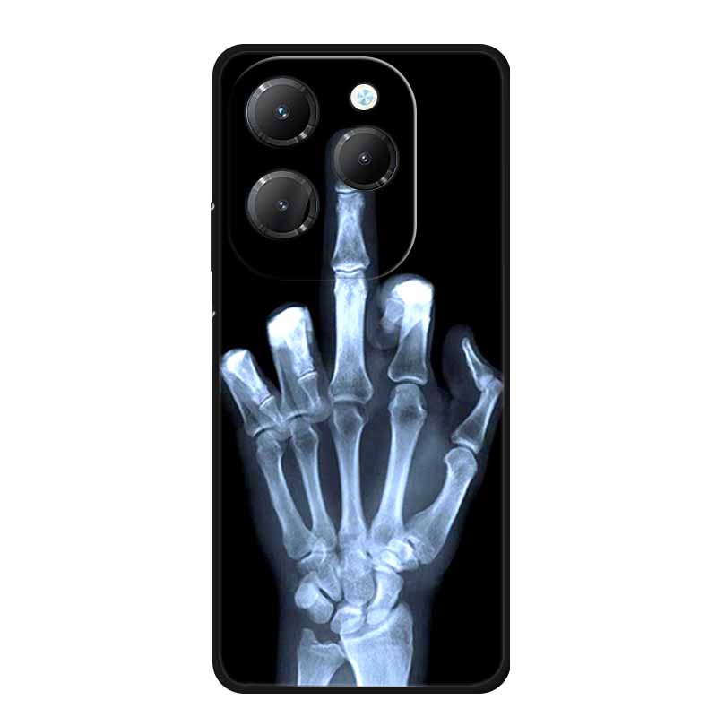 For Infinix Hot 40 Pro Case Animals Soft Silicone TPU Cover Phone Cases For Infinix Hot 40i Hot40 X6837 Protective Wolf Coque