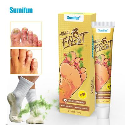20g Juckreizstillende Fußcreme Salbe Amazon Fußpilzcreme Antibakterielle Juckreizlindernde Creme Topische Creme Fußcreme