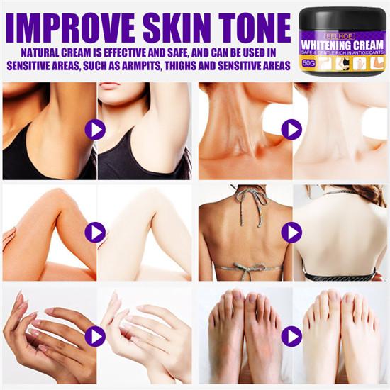 Armpit Whitening Cream Skin Lightening Bleaching Cream Underarm Dark Skin Legs Knees Whitening Intimate Body Lotion Moisturizing