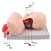 Neonatal Tracheal Intubation Training Manikin