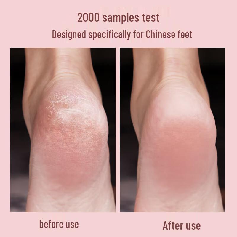 MKS Electric Foot Callus Remover