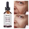 5ML/15ML/30ML/50ML/TRSTAY Ultimate Wrinkle Resistant Facial Essence, Leaving Skin Radiant