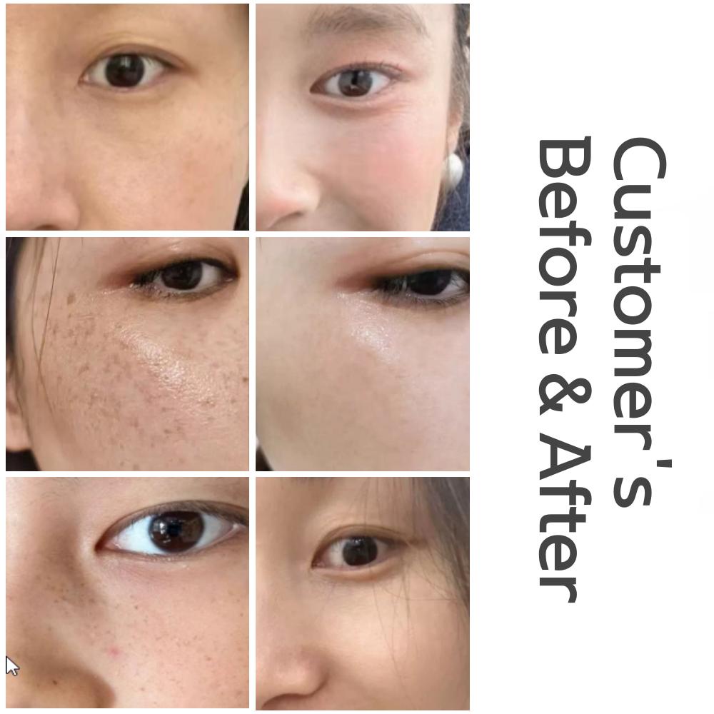 Uonomi Rozjaśniający (Usuwanie piegów) Krem 20g