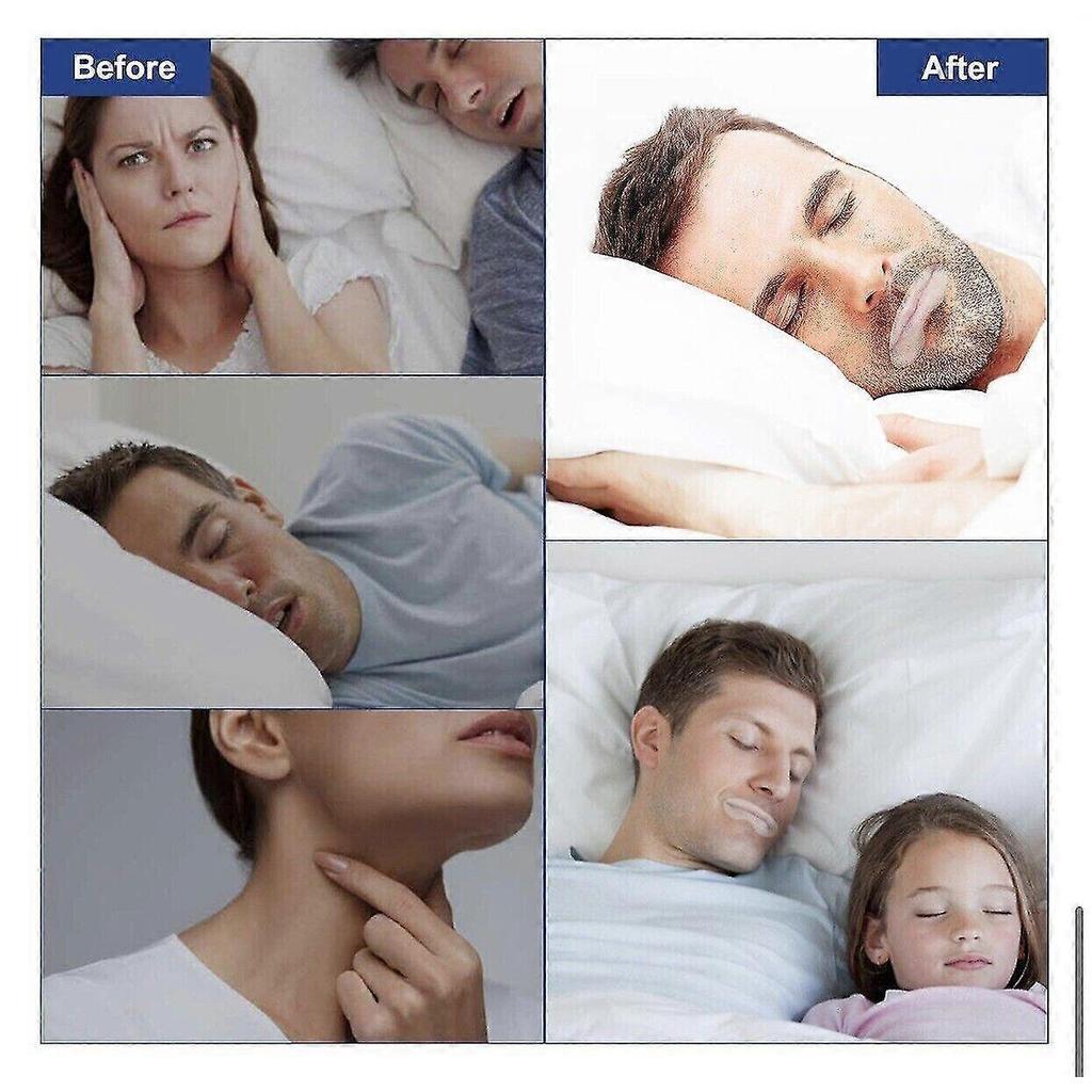 90 Pieces Anti-snoring Mouth Patch To Correct Patch To Improve Mouth