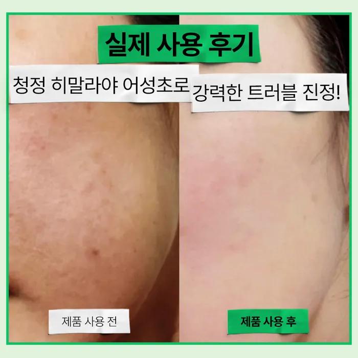 [Problem Skin]_Eoseongcho 80 Hyaluronic Acid Trouble Soothing Mildly Acidic Non-Toner 300ML