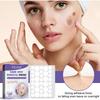 EELHOE Hydrocolloid Acne Patches Gentle Face Spot Remover Smooth Clean Skin Blemish Patch 60 Pack