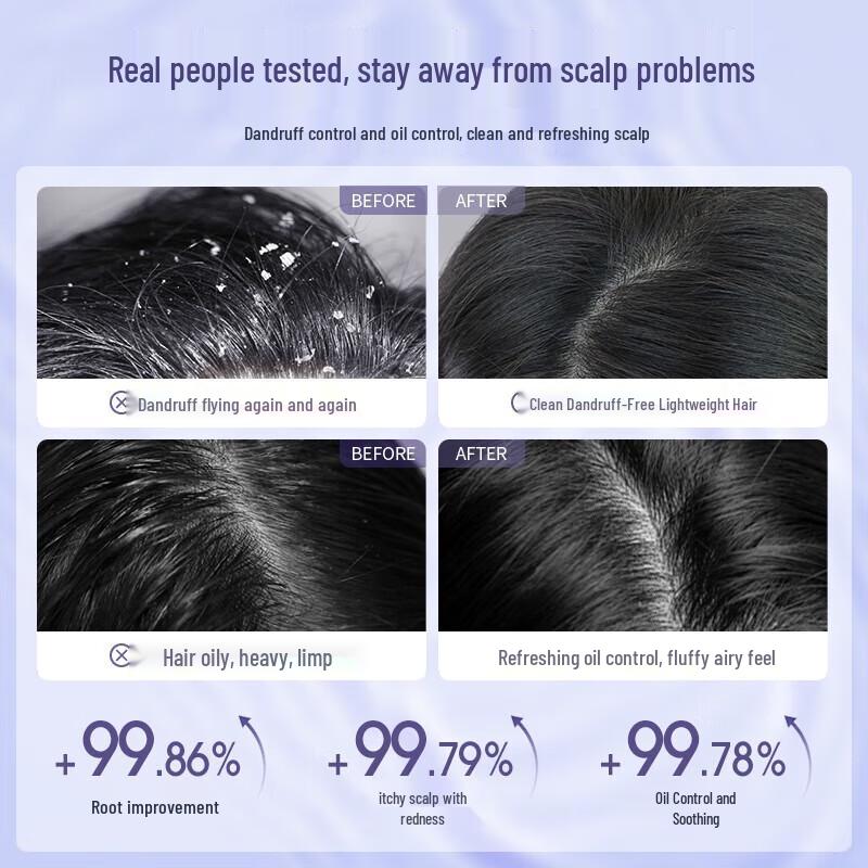 Three Magicians Dual Acid Shower Gel & Anti-Dandruff Shampoo Set