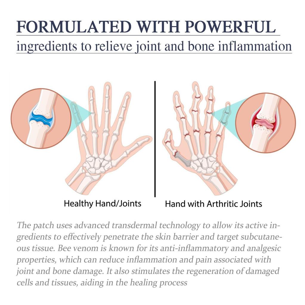 XIMONTH Bee Venom Joint Spray, Relieves Joint and Muscle Discomfort, Relaxes Tense and Sore Muscles, 30ml