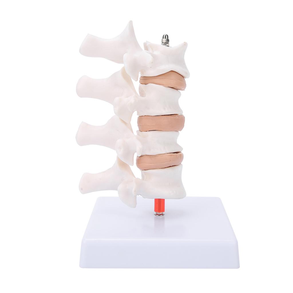 Professionelles Osteoporose-Modell, menschliches anatomisches Wirbelsäulenmodell für die Lehrdemonstration