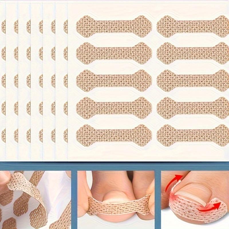 

Вросший паронихий Корректирующие полоски для ногтей Анти F 10 шт. Корректирующие полоски для вросшего паронихия ногтя Анти F