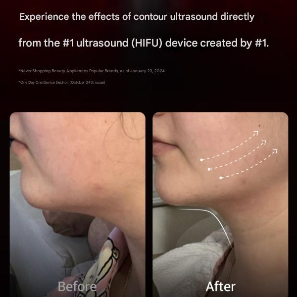 Medicube [AGE‑R] Disparo de Alta Concentración