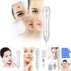 Small White Spot Removal Pen Advanced Laser Beauty Device For Home And Salon Use