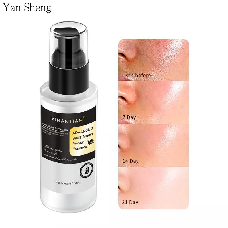 Snail Protein Essence Solution Brightens Skin Color and Shrinks Pores