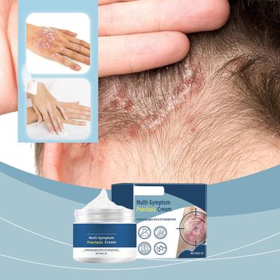 Care Cream Moisturizing Herbs Cool Itching Moisturizing Skin Without Dandruff Light Erythema