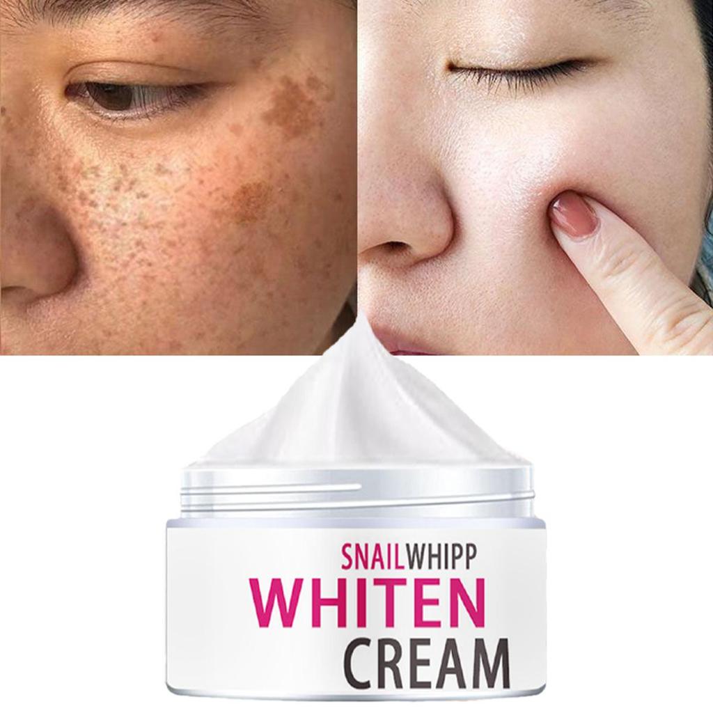 Facial freckle cream targets black spots and irregular pigmentation to reduce black spots  Skin Whitening, Moisturizing