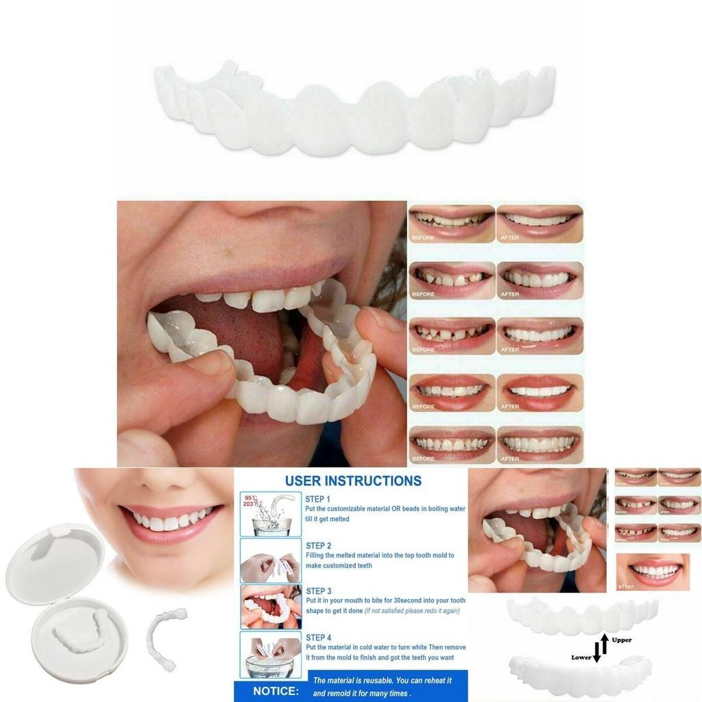Lower Teeth Upper Dental Veneers Denture Tooth Cover Simulati Set