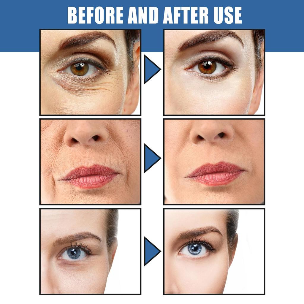 West&Month 5-Second Retinol Eye Cream Reduces Fine Lines Around Eyes Hydrates and Moisturizes Firms Skin For Face Use 30ml