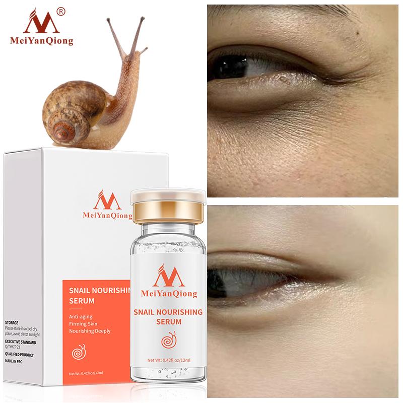 Anti-Aging Schnecken- und Goldessenz, feuchtigkeitsspendende Hyaluronsäure, feuchtigkeitsspendendes, nährendes Gesichtsserum, 12 ml