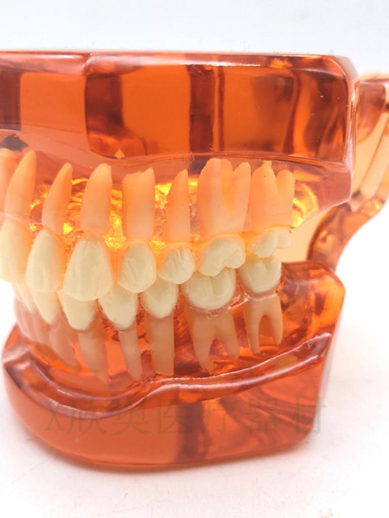 Zahnmedizinisches Lehr-Modell Ortho Metall/Keramik Mit/Ohne Bracket Zahnmedizinische Zubehörteile Kieferorthopädie Zahnersatz Modellierwerkzeug