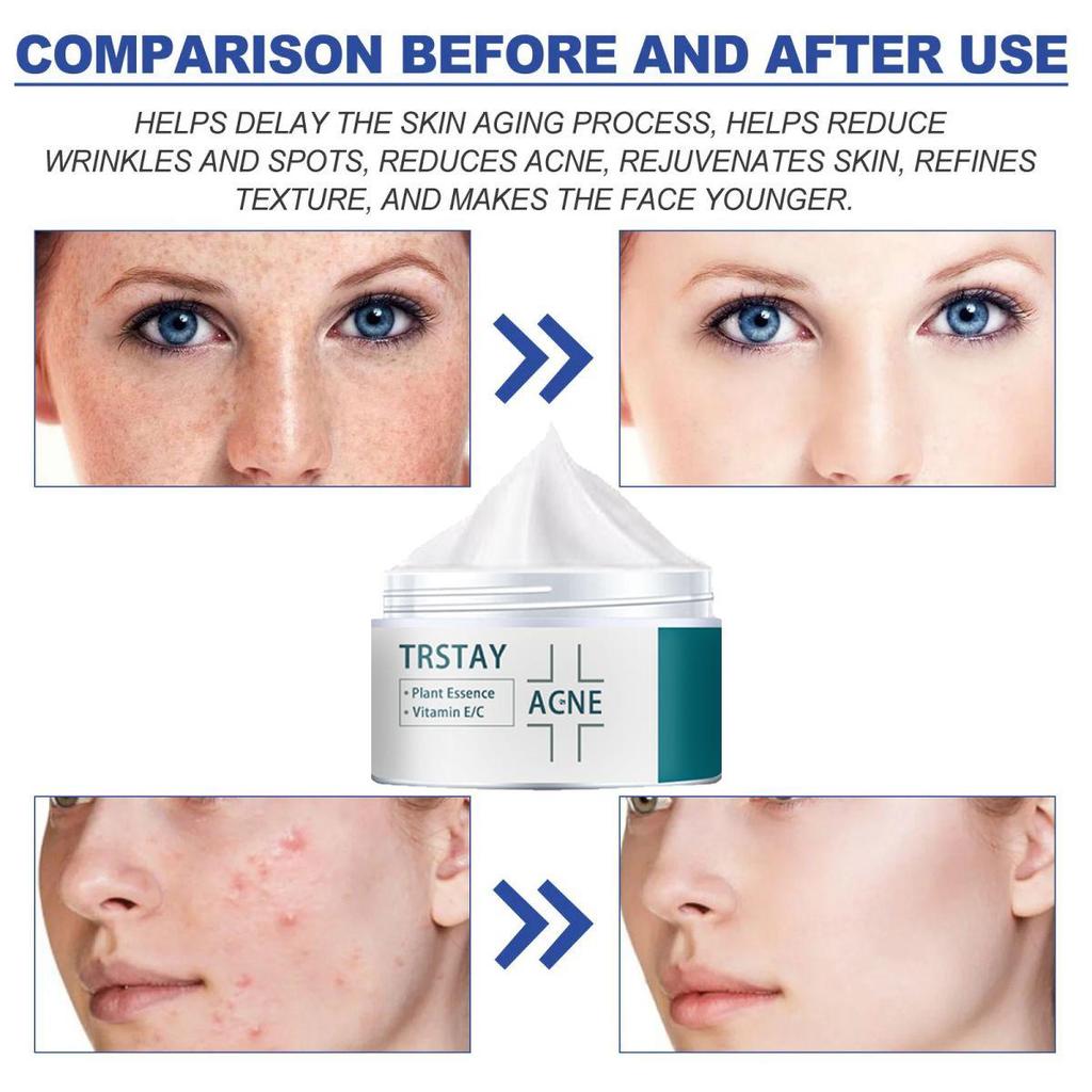 The Cream Is Gentle and Non-irritating, Firms the Skin, Brightens the Complexion, Reduces Markings, Hydrates and Nourishes the Skin