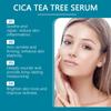 Centella Asiatica Serum Moisturizing And Nourishing Skin Facial Brightening Skin Care Serum 30ml