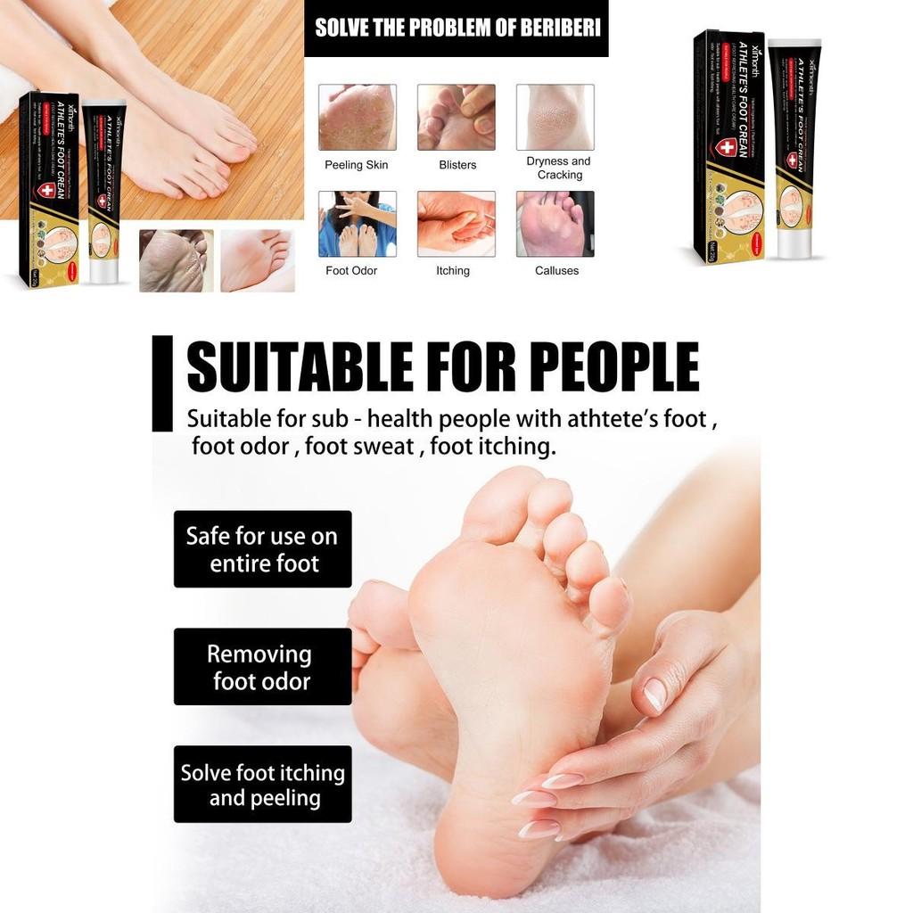 Ximonth Foot Odor Removal Cream With Soothing Formula For Itchy And Dry Skin Care