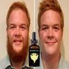 Beard Oils Split Ends Beard Growth Oil For Growth Men Beard Growth