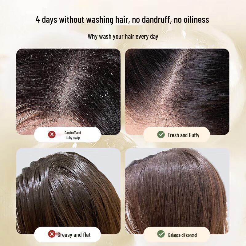 Bawang Ginger Amino Acid Anti-Dandruff Shampoo 720ml