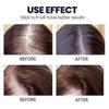 3Pcs Hair Growth Serum Spray For Women & Men Hair Growth Scalp Treatment
