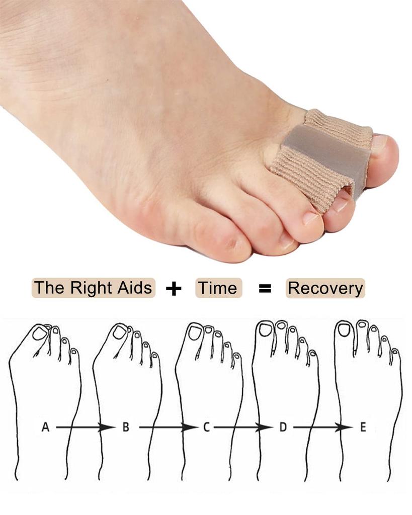 Gel Toe Separator, Toe Corrector, Toe Separator (Double Ring Bunion Corrector, 4 Pack)