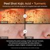 Exfoliating Kojic Acid Turmeric Serum, AHA/BHA & Niacinamide Facial Exfoliator, Brightening & Even Tone Face Serum for Dark Spots, 80ml
