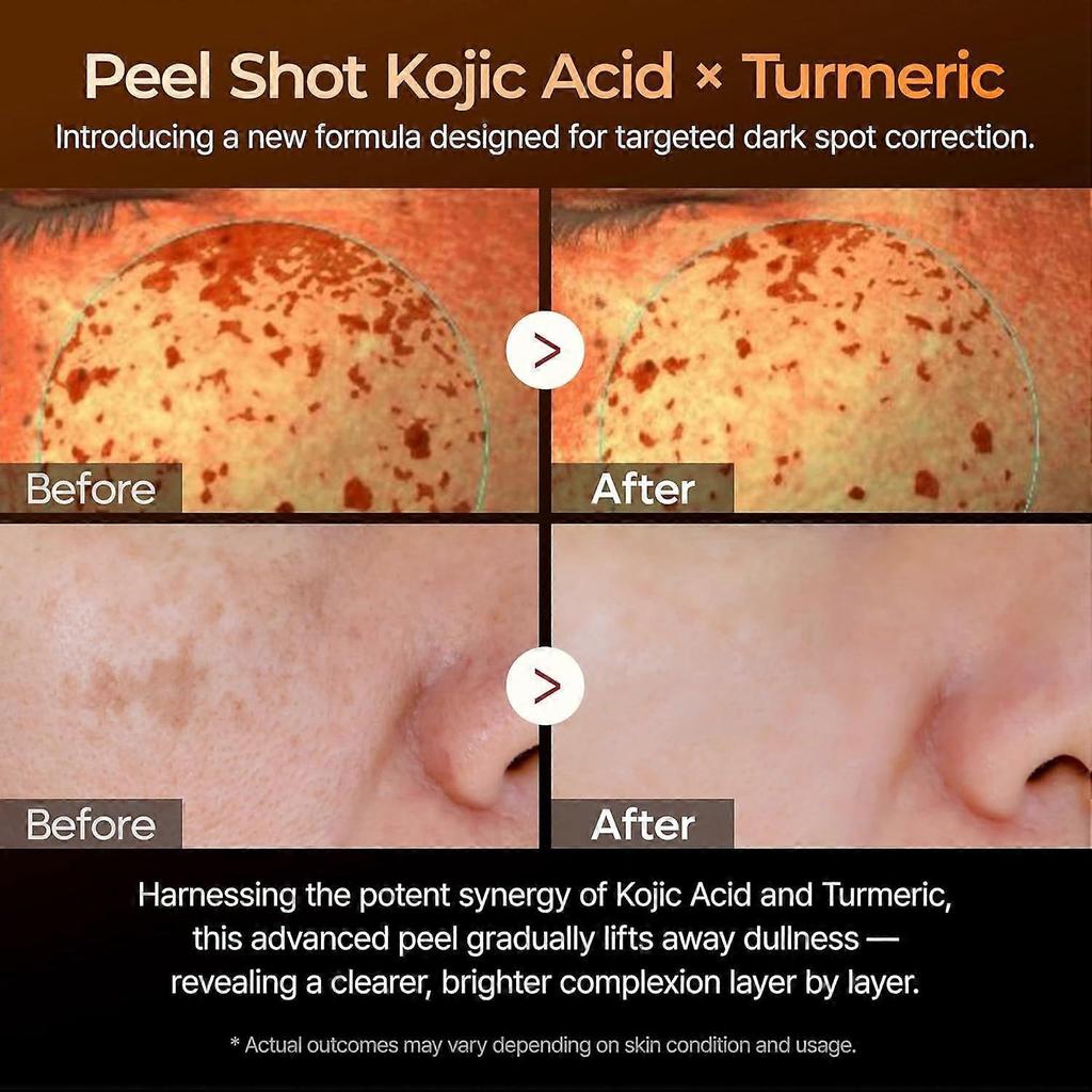 Exfoliating Kojic Acid Turmeric Serum, AHA/BHA & Niacinamide Facial Exfoliator, Brightening & Even Tone Face Serum for Dark Spots, 80ml