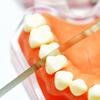 5 Stück oder 10 Stück Dental Metall Polierstab Polier-Schleifstreifen mit Verzahnung Ganzer Streifen Gezahnte Kante 4mm Zahnaufhellungsmaterialien