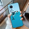 Whale Sharks Fish For Honor Magic 8 Pro 5 6 7 Lite Case Cover For Honor 90 70 50 400 200 X8a X8b X9a X9b X9c