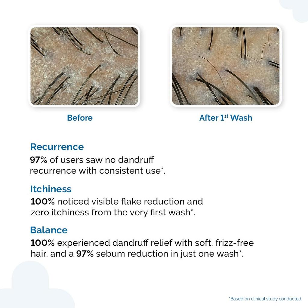 The Derma Co Triple Actives Anti-Dandruff Shampoo 200 ml | Removes Dandruff & Soothes Itchy Scalp for Men & Women