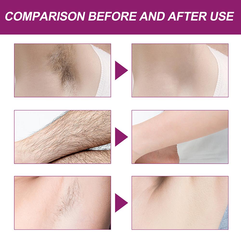 Hair Removal Spray Painless Inhibitor Remove Armpit Arm Depilatory Women Care Body For Men Perm Y5H4