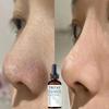 Hyaluronic Acid Face Serum Anti-Aging Shrink Pore Whitening Moisturizing Essence Face Cream Dry Skin Care Korean Skin Care