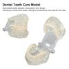 Transparent Dental Model Clear Structure Educational Dental Teeth Display Model for Dental Clinic