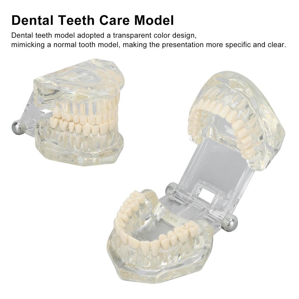 Transparent Dental Model Clear Structure Educational Dental Teeth Display Model for Dental Clinic