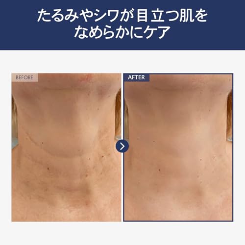 NATUREKIND Intense Lifting Neck Cream 50g for Neck, Décolleté Care, NATUREKIND