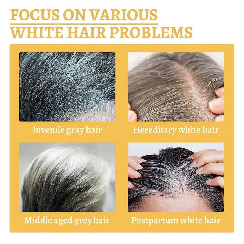 3x Hair Growth Essence Oil for Ganoderma Nutrient Essential Oil Repairs Damage Restore Soft Fast Treatment Prevent Thinning Dry