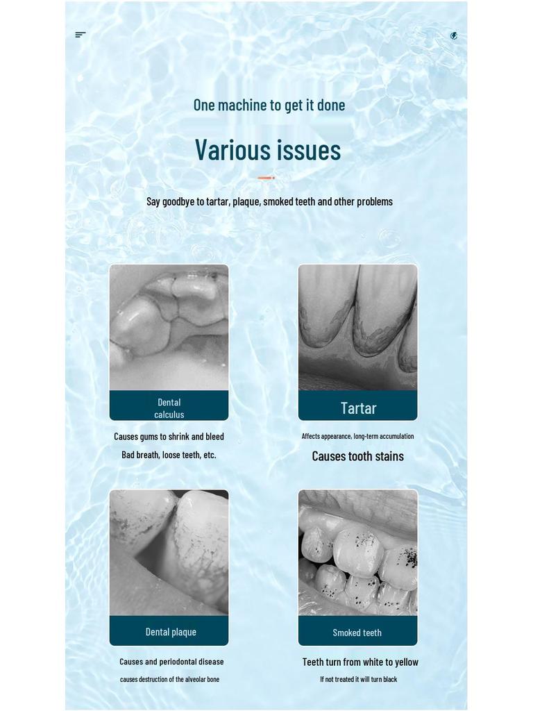 Portable Ultrasonic Electric Tooth Cleaner - Tartar & Plaque Remover, Teeth Whitening Device